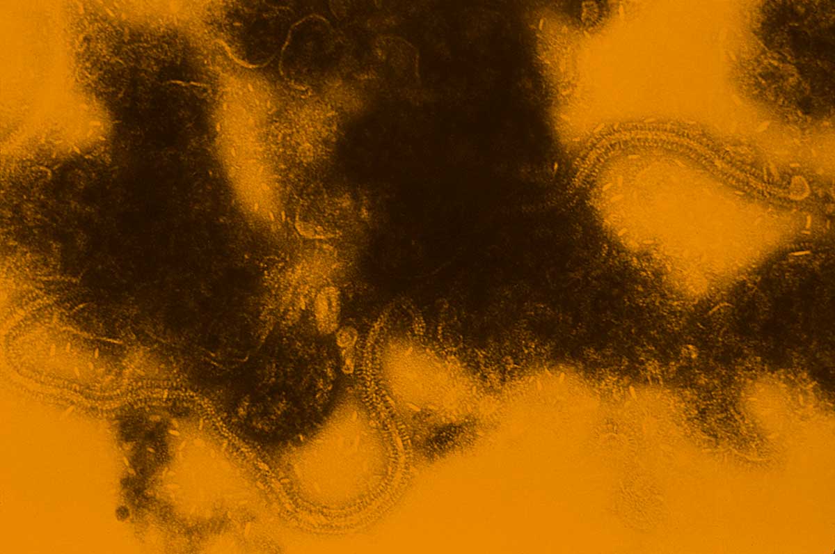 Nueva alerta con el virus VRS