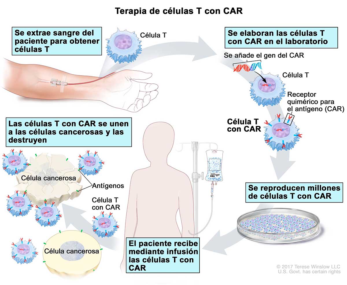 CAR-T para tumores sólidos
